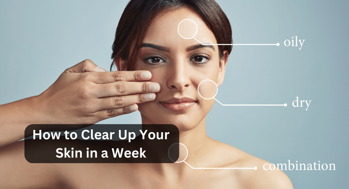 How to Clear Up Your Skin in a Week