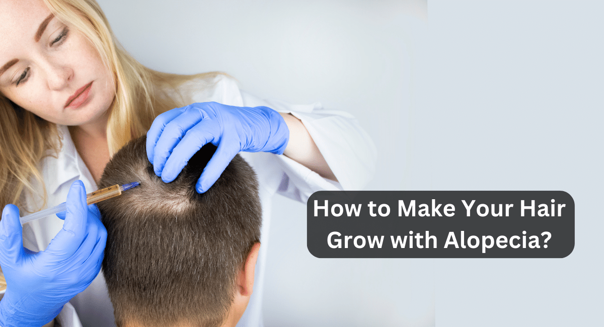 How to Make Your Hair Grow with Alopecia?